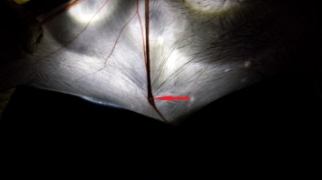 Gap in knuckle typical of juvenile bats. Photo: KPatriquin